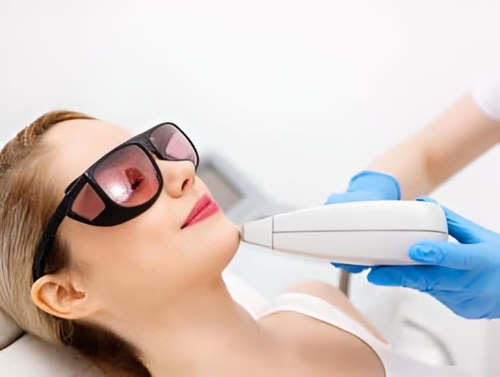 Laser Hair Removal